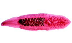 Clonorchis sinensis